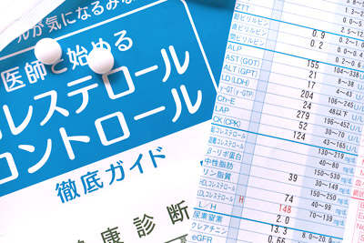 脂質異常症のイメージ画像